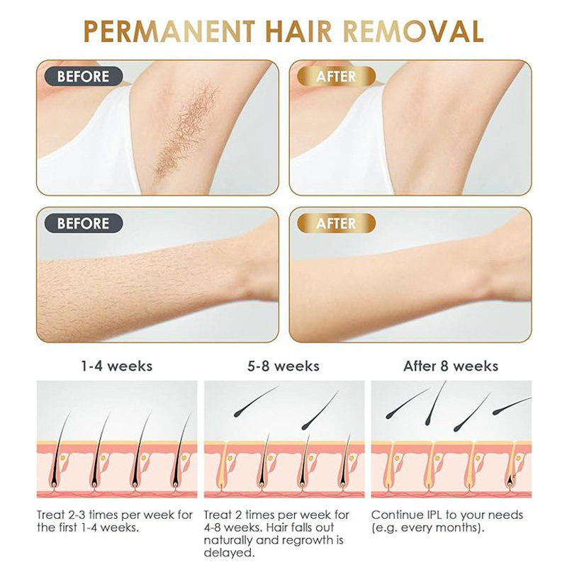 Beakey IPL Hair Removal Device Laser Painless Permanent System for Face & Body-Black
