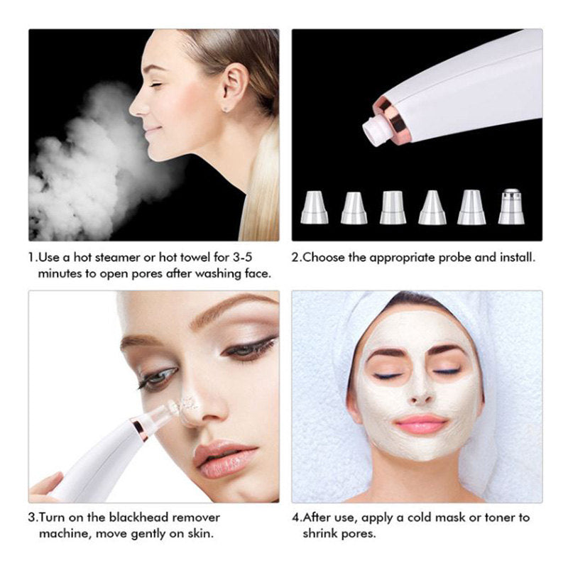 Beakey Blackhead Remover 3 Levels with 6 Replaceable Head & 4 Acne Extractor Tool