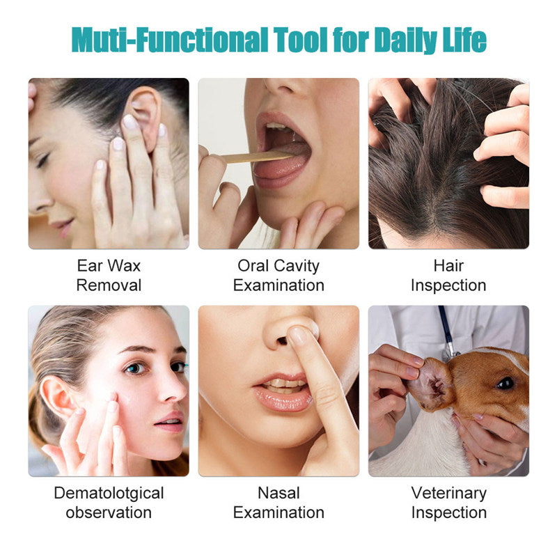 Beakey Ear Wax Removal Tool Kits with HD Camera and 6 LED Lights Replacement for iOS Android-White