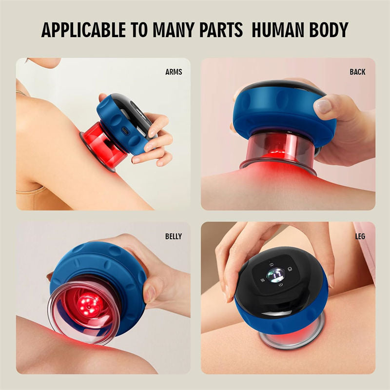 Beakey Smart Cupping Therapy Massager with Red Light for Muscle Relief-Blue