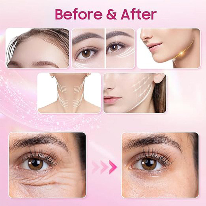 Beakey Face Neck Beauty Device Red-Light-Therapy 7 Color LED for Skin Care