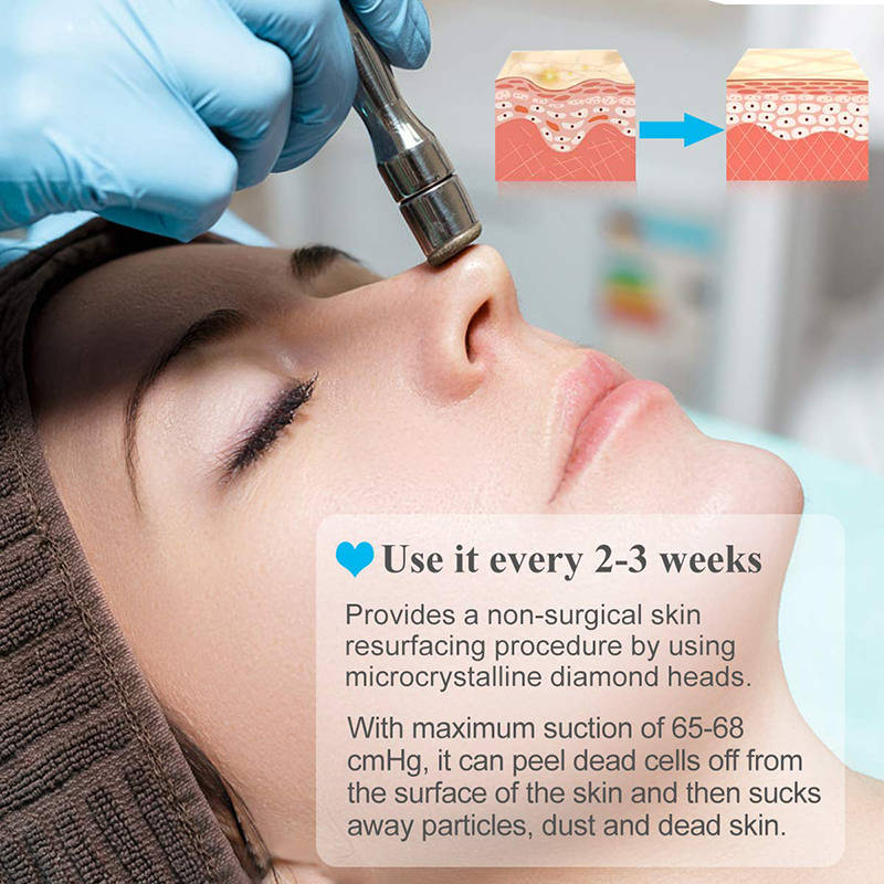 Beakey Diamond Microdermabrasion Machine for Skin Peeling Rejuvenation