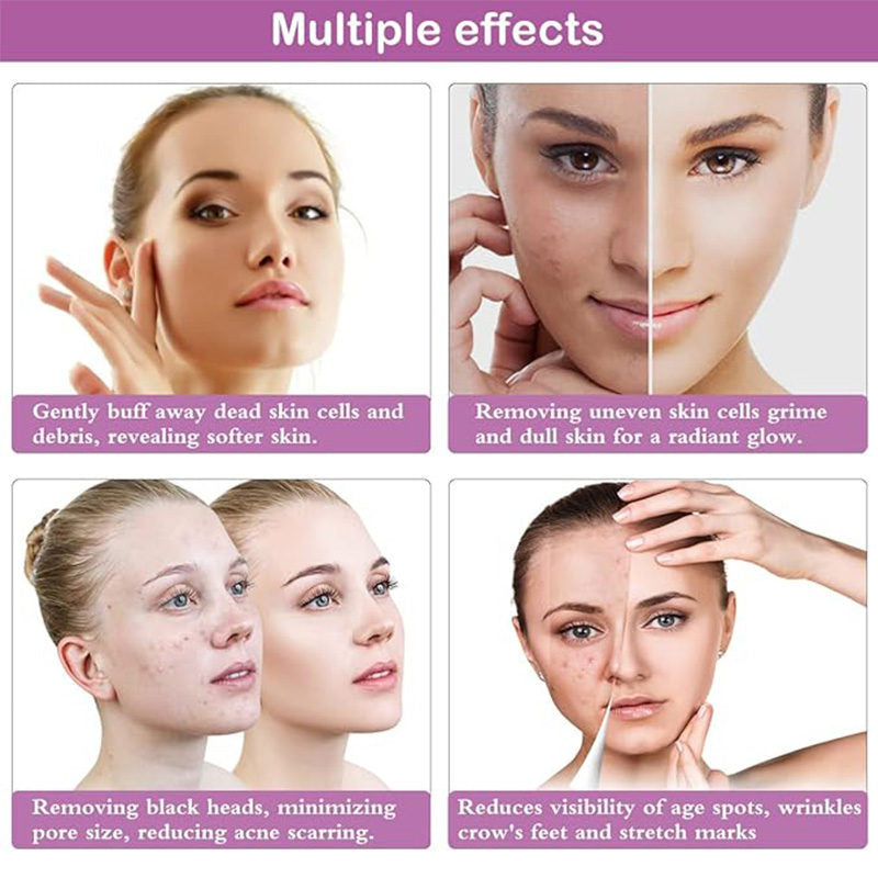 Beakey Diamond Microdermabrasion Machine for Skin Peeling Rejuvenation