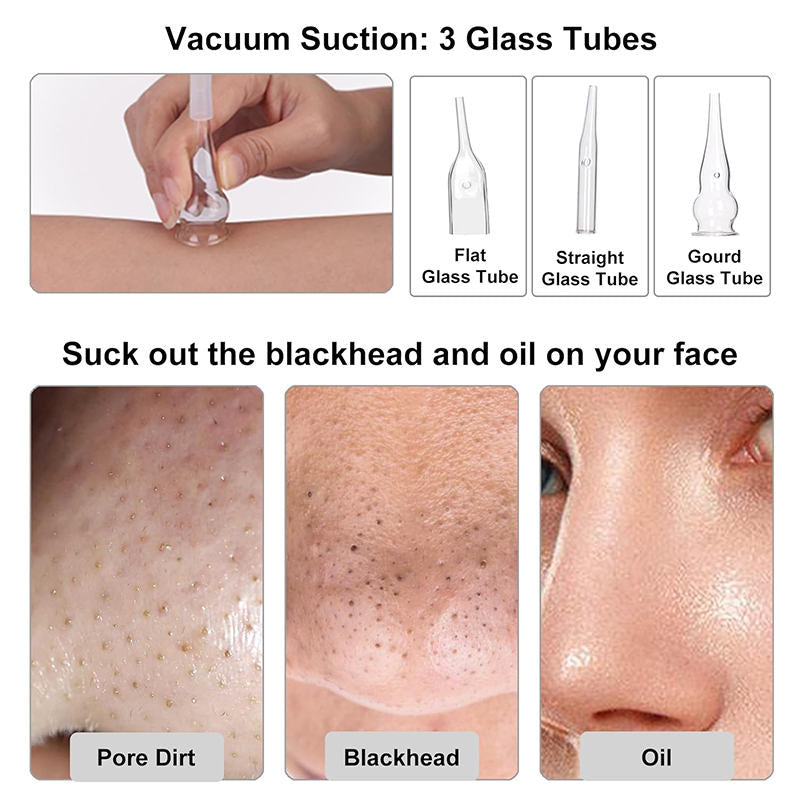 Beakey 3-in-1 Microdermabrasion Machine 0-68cmHg Strong Suction Power