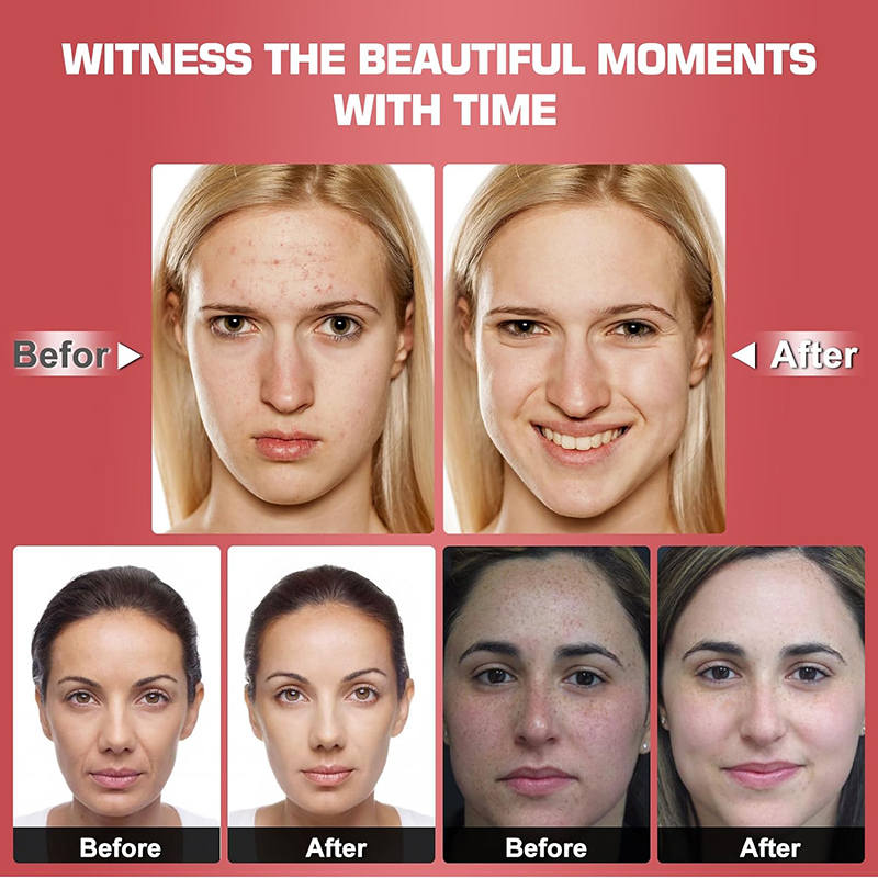 Beakey Red Light Mask 7 Colors Rechargeable At-Home Photon Skin Care Device