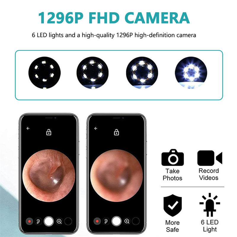 Beakey Ear Wax Removal Tool Kits with HD Camera and 6 LED Lights Replacement for iOS Android-Black