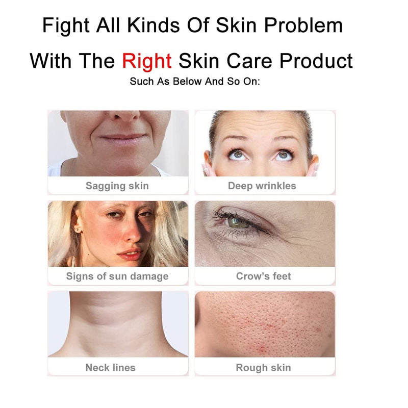 Beakey Facial Neck Massager with 3 Colors LED Therapy for Skin Lifting